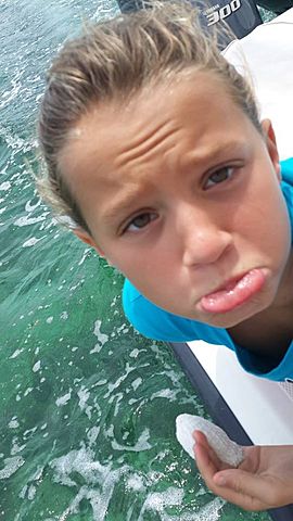 The time I got sticthes