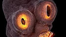 Timeline: Taenia Solium