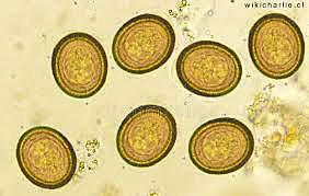 Periodo de incubación: Cisticercosis