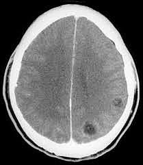Estudios de neuroimagen