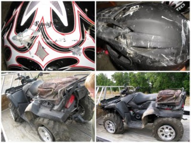 My cousin's 4 - wheeler accident