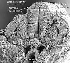 Day 20: Musculoskeletal somitogenesis