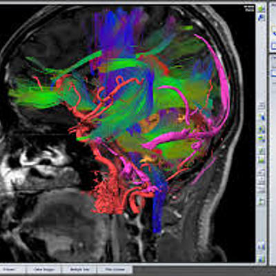 Timeline: SISTEMA DE NEURONAVEGACIÓN