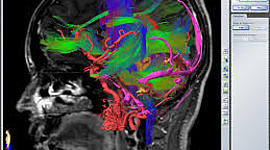 Timeline: SISTEMA DE NEURONAVEGACIÓN