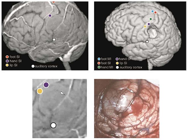 Sir. Victor Alexander Haden Horsley