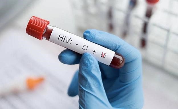 VIH (virus de la inmunodeficiencia humana)