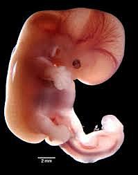 day 44: Embryo changes more