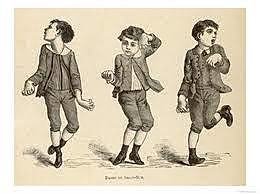 Edad media: “Mal de San Vito”