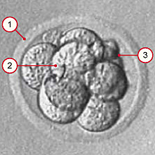 Day 1- Secretory Phase (Stage 1)