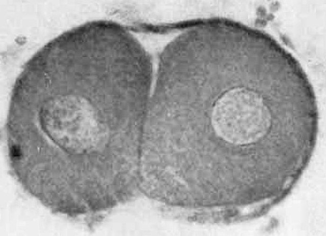 Day 2- Secretory Phase (Stage 2)