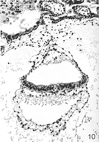 Day 16- Secretory Phase (Stage 7)