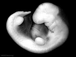 Day 32- Secretory Phase (Stage 14)