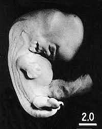 Day 41- Secretory Phase (Stage 17)