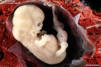 Day 50- Secretory Phase (Stage 20)