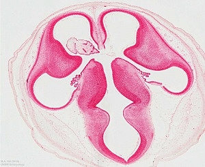 Days 28-31: Stage 13