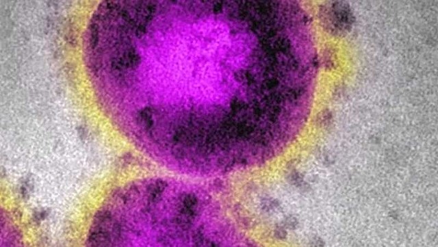 The first death from COVID-19 in Colorado