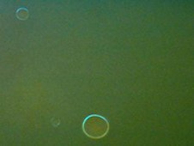 Cancer treatment Delivery Research - microencapsulation