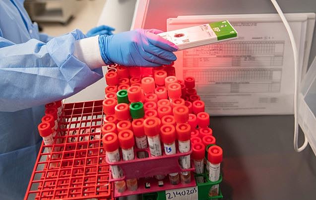 Van tres semanas de espera y el Gobierno pide dos más para la llegada de reactivos para COVID-19