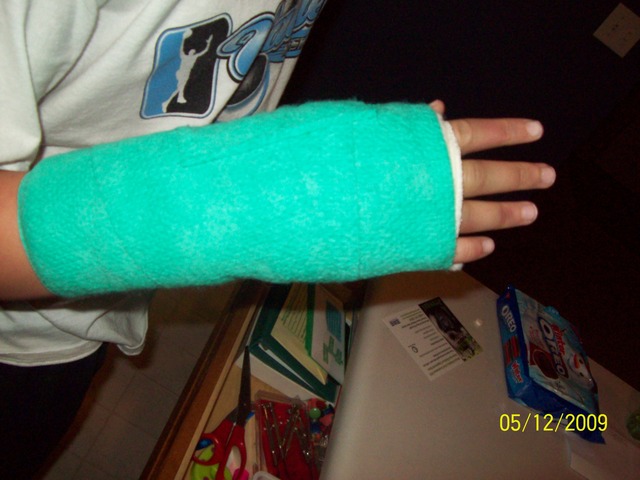 Broken Hand