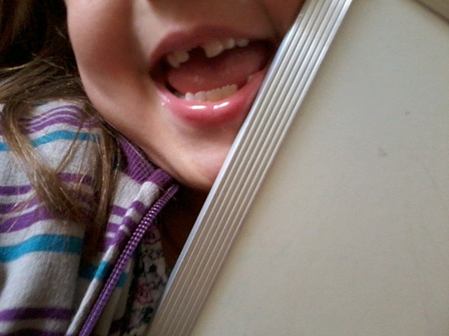 I lost my first tooth