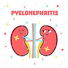 Pielonefritis