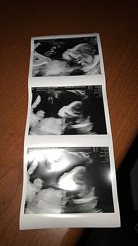 Finding out I was going to be a big sister