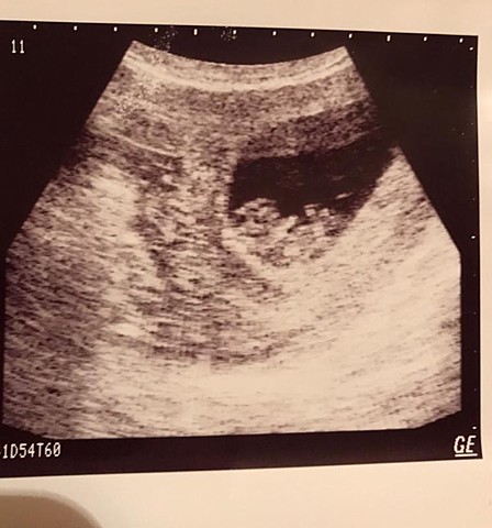 Etapa prenatal (periodo zigoto)