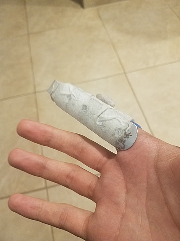 broken finger