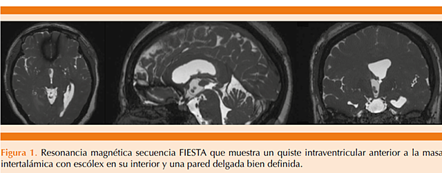 Estudios de neuroimagen