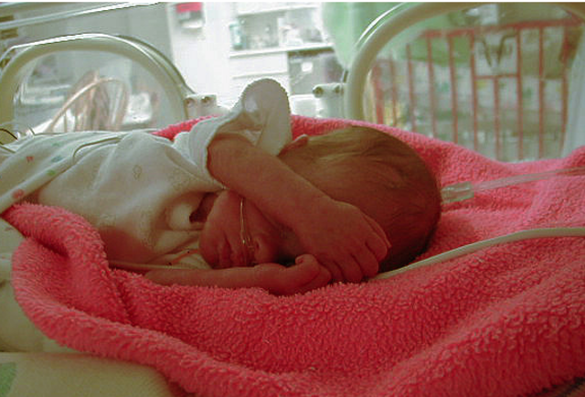 Being born and the complications