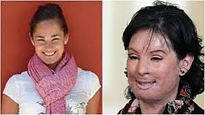 Caso Natalia Ponce de León