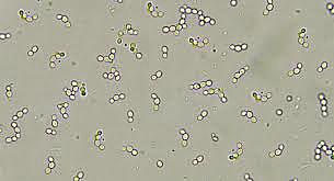 Primeres sequències completes de genomes d'organismes