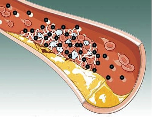 Día #3 La interleuquina-6 o IL6) no solo generan inflamación local.