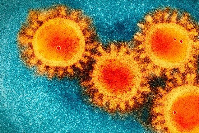 COVID-19: Científicos confirman que su origen es natural