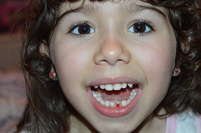 se me cayó mi primer diente