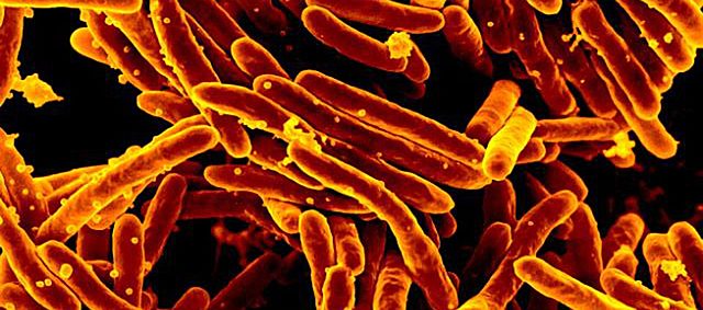 Attacked with mild tuberculosis