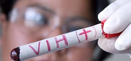 Reducen VIH en seis pacientes gracias a trasplante de células madre