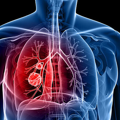 Timeline: EL CORONAVIRUS EN EL CUERPO HUMANO
