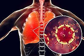 cuales son los sintomas del coronaviruz?