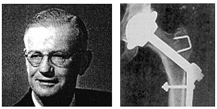 EL ANTECESOR DEL REEMPLAZO TOTAL
