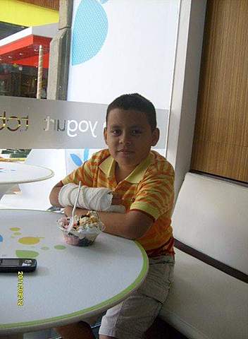 I still have broken my hand