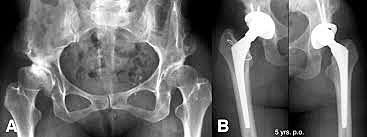 los Drs. Harold Dunn y Wallace E. Hess, de Salt Lake City