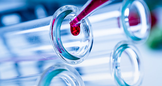 ¿Cuáles son los síntomas de la COVID-19?