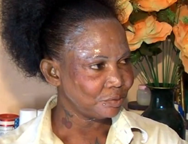 Skin Bleaching in Jamaica