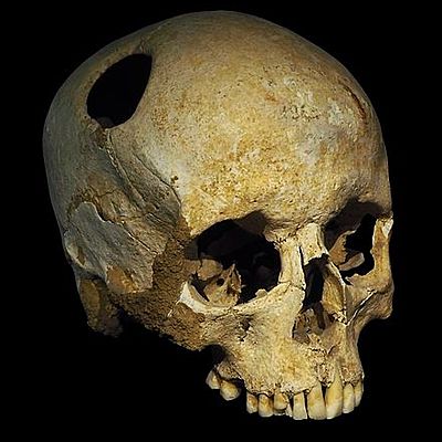 Timeline: Historia del Concepto de Anormalidad