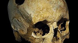 Timeline: Historia del Concepto de Anormalidad