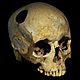 440px trepanated skull of a woman p4140363 black
