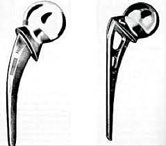 endoprótesis metálicas