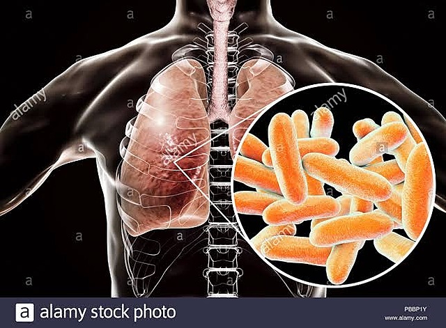 Robert Koch descubre el bacilo de la tuberculosis y cólera, poco despues
