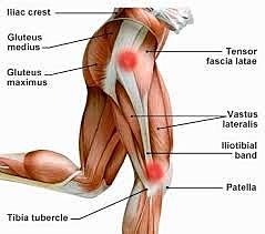 Campbell y MacAusland